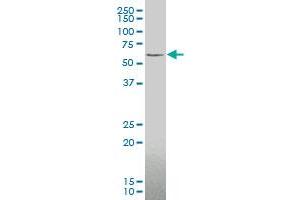 ZIC3 monoclonal antibody (M05), clone 2C1 Western Blot analysis of ZIC3 expression in Y-79 . (ZIC3 antibody  (AA 182-274))