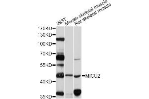 Western blot analysis of extracts of various cell lines, using MICU2 antibody (ABIN5998228) at 1/1000 dilution. (EFHA1 antibody)