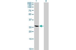 Western Blot analysis of RAB40A expression in transfected 293T cell line by RAB40A MaxPab polyclonal antibody. (RAB40A antibody  (AA 1-277))