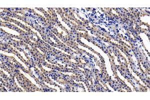 Detection of IL11Ra in Rat Kidney Tissue using Polyclonal Antibody to Interleukin 11 Receptor Alpha (IL11Ra) (IL11RA antibody  (AA 24-371))
