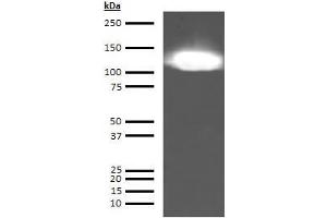 Western Blotting (WB) image for anti-KININOGEN HMW antibody (ABIN613715) (KININOGEN HMW antibody)