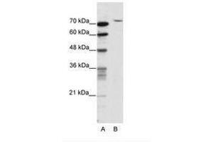 Image no. 1 for anti-TAF6 RNA Polymerase II, TATA Box Binding Protein (TBP)-Associated Factor, 80kDa (TAF6) (N-Term) antibody (ABIN202866) (TAF6 antibody  (N-Term))
