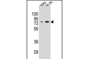 ENTPD3 Antibody (C-term) (ABIN654673 and ABIN2844368) western blot analysis in K562 and HL-60 cell line lysates (35 μg/lane). (ENTPD3 antibody  (C-Term))