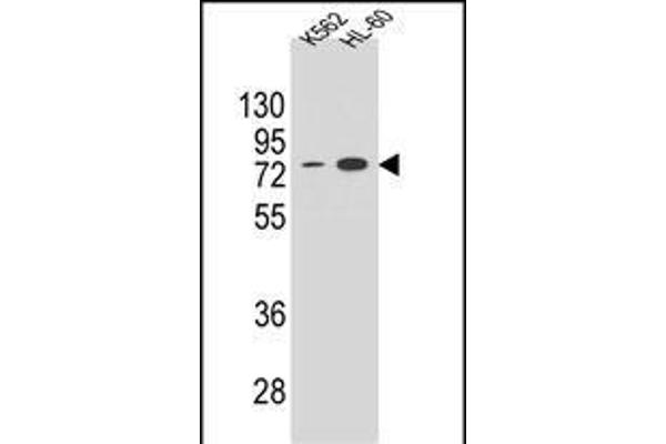 ENTPD3 Antikörper  (C-Term)