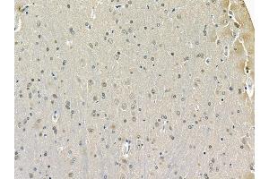 Parkin Mouse Monoclonal Antibody at 1/100 staining rat brain tissue by IHC-P.