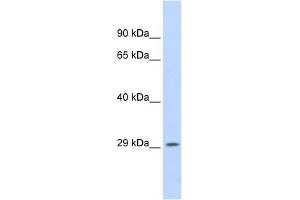 WB Suggested Anti-PSME1 Antibody Titration: 0. (PSME1 antibody  (Middle Region))