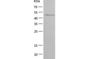 Western Blotting (WB) image for Myeloproliferative Leukemia Virus Oncogene (MPL) (AA 26-491) protein (His tag) (ABIN7124044) (MPL Protein (AA 26-491) (His tag))