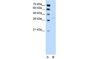 HSD17B1 antibody used at 0. (HSD17B1 antibody)