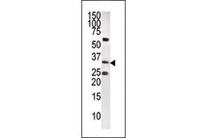 CTDSP1 antibody  (C-Term)