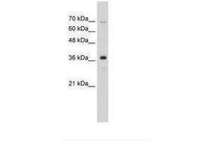 Image no. 2 for anti-Zinc Finger Protein 265 (Zranb2) (AA 149-198) antibody (ABIN6736297) (ZNF265 antibody  (AA 149-198))