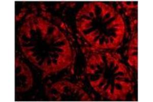 Immunofluorescence of TEM1 in Human Colon cells with TEM1at 20 µg/ml. (CD248 antibody  (C-Term))