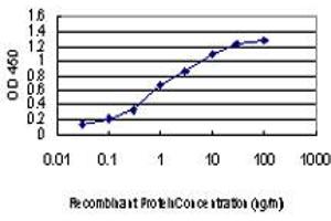 Detection limit for recombinant GST tagged IRAK2 is approximately 0. (IRAK2 antibody  (AA 111-210))