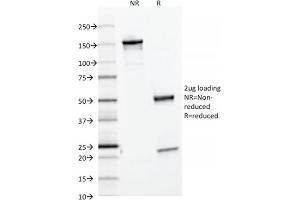 SDS-PAGE Analysis Purified Ferritin, Light Chain Mouse Monoclonal Antibody (FTL/1386). (FTL antibody  (AA 38-165))