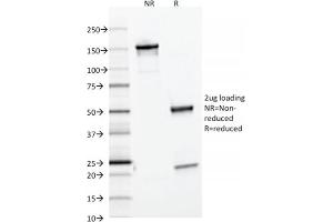 SDS-PAGE Analysis Purified Ferritin, Light Chain Mouse Monoclonal Antibody (FTL/1386).