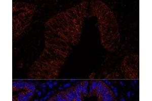 Immunofluorescence analysis of Human colon carcinoma cells using MUC2 Polyclonal Antibody at dilution of 1:100. (MUC2 antibody)