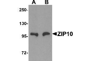 Western Blotting (WB) image for anti-Solute Carrier Family 39 (Zinc Transporter), Member 10 (SLC39A10) (Middle Region) antibody (ABIN1031176) (SLC39A10 antibody  (Middle Region))