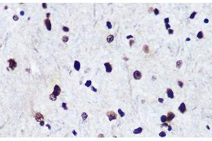 Immunohistochemistry of paraffin-embedded Rat brain using Phospho-Smad2(S465/467)/Smad3(S423/425) Polyclonal Antibody at dilution of 1:100 (40x lens). (SMAD2 antibody  (pSer423, pSer425, pSer465, pSer467))