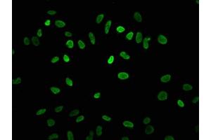Immunofluorescence staining of Hela cells with ABIN7139182 at 1:7. (HIST1H3A antibody  (acLys4))