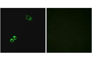 Immunofluorescence analysis of MCF7 cells, using GPRC6A Antibody.