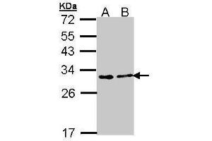WB Image Sample (30 ug of whole cell lysate) A: A431 , B: H1299 12% SDS PAGE antibody diluted at 1:1000 (FKBP3 antibody  (Center))