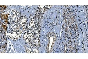 IHC analysis of GRX2/GLRX2 using anti-GRX2/GLRX2 antibody (ABIN7599022).