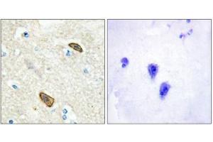 Immunohistochemical analysis of paraffin-embedded human brain tissue using PLXDC1 antibody. (PLXDC1 antibody  (Internal Region))