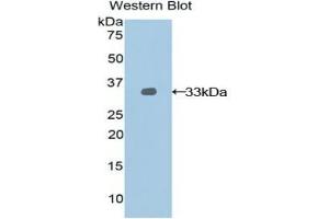 Detection of Recombinant NEXN, Rat using Polyclonal Antibody to Nexilin (NEXN) (NEXN antibody  (AA 214-455))