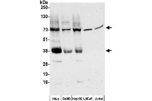 anti-Solute Carrier Family 16 (Monocarboxylic Acid Transporters), Member 3 (SLC16A3) (AA 400-450) antibody