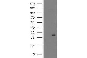HEK293T cells were transfected with the pCMV6-ENTRY control (Left lane) or pCMV6-ENTRY PGAM2 (Right lane) cDNA for 48 hrs and lysed. (PGAM2 antibody)