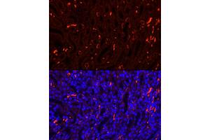 Immunofluorescence analysis of Mouse kidney using SLC4 antibody (7391 ) at dilution of 1:100. (Band 3/AE1 antibody  (AA 1-353))