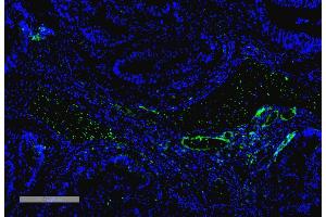 Immunohistochemistry analysis using Mouse Anti-VPS35 Monoclonal Antibody, Clone 10A8 (ABIN6932999). (VPS35 antibody  (HRP))