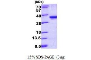 Image no. 1 for Actin Related Protein 2/3 Complex, Subunit 2, 34kDa (ARPC2) (AA 1-300) protein (His tag) (ABIN6387146)