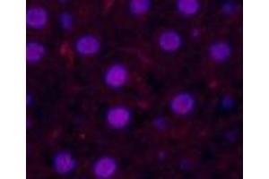 Immunofluorescence (IF) image for anti-Caspase 3 p17 (Cleaved-Asp175) antibody (ABIN7251013)