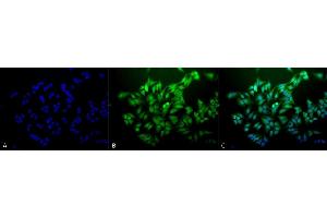 Immunocytochemistry/Immunofluorescence analysis using Mouse Anti-Ubiquitin Monoclonal Antibody, Clone 6C11-B3 (ABIN361817 and ABIN361816). (Ubiquitin antibody)