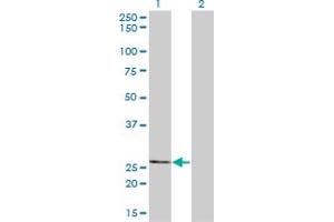 Western Blot analysis of THTPA expression in transfected 293T cell line by THTPA monoclonal antibody (M01), clone 3F6.