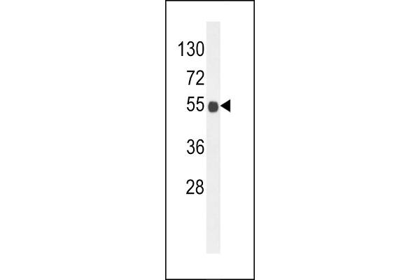 B3GNT6 antibody  (AA 146-173)