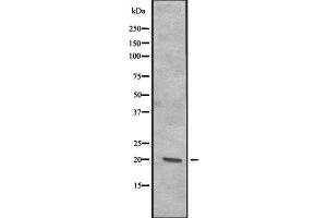 Western blot analysis of CENPR expression in A-431 cell lysate at 25ug/lane ,The lane on the left is treated with the antigen-specific peptide. (ITGB3BP antibody  (Internal Region))