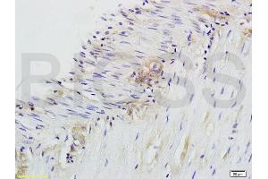 Formalin-fixed and paraffin embedded rat colitis labeled with Anti-CD28 Polyclonal Antibody, Unconjugated (ABIN674604) at 1:200 followed by conjugation to the secondary antibody and DAB staining. (CD28 antibody  (AA 1-120))