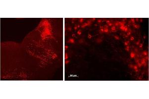 ABIN768606 (0. (Tryptophan Hydroxylase 2 antibody  (Internal Region))