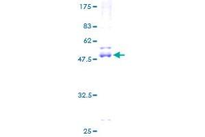 Image no. 1 for NME/NM23 Nucleoside Diphosphate Kinase 6 (NME6) (AA 1-194) protein (GST tag) (ABIN1312701) (NME6 Protein (AA 1-194) (GST tag))