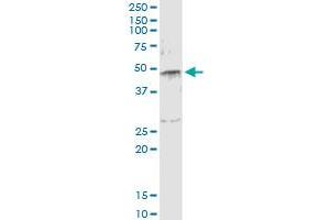 Immunoprecipitation of SERPINE1 transfected lysate using anti-SERPINE1 monoclonal antibody and Protein A Magnetic Bead , and immunoblotted with SERPINE1 MaxPab rabbit polyclonal antibody. (PAI1 antibody  (AA 86-185))