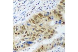 Immunohistochemical analysis of WDR48 staining in human colon formalin fixed paraffin embedded tissue section. (WDR48 antibody)