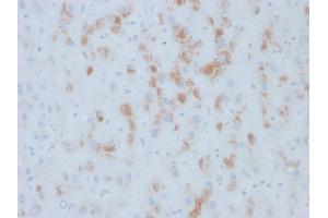 Immunohistochemistry (IHC) image for anti-Cytochrome P450, Family 2, Subfamily E, Polypeptide 1 (CYP2E1) (C-Term) antibody (ABIN6939224)