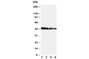 Western blot testing of DLL3 antibody and recombinant human protein