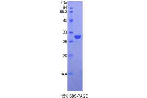 SDS-PAGE (SDS) image for Vaccinia Related Kinase 1 (VRK1) (AA 46-292) protein (His tag) (ABIN2122315)