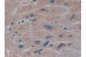 Detection of PKBb in Human Liver Tissue using Polyclonal Antibody to Protein Kinase B Beta (PKBb) (AKT2 antibody  (AA 142-412))
