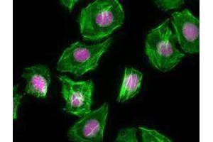 Immunofluorescence (IF) image for anti-Antigen Identified By Monoclonal Antibody Ki-67 (MKI67) antibody (Alexa Fluor 647) (ABIN2657968) (Ki-67 antibody  (Alexa Fluor 647))