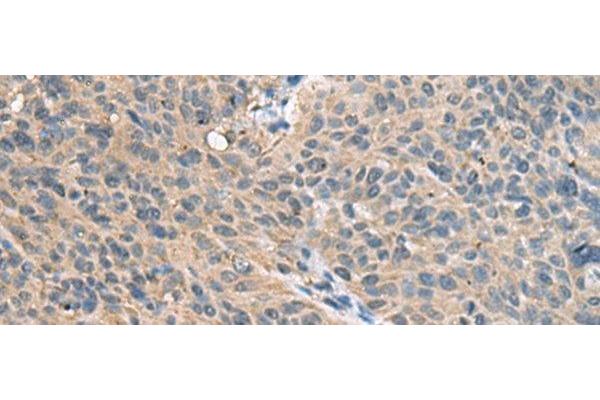 FAM19A4 antibody