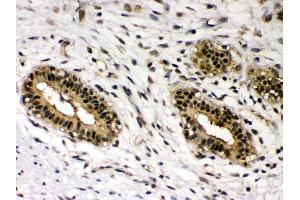 Immunohistochemistry (IHC) image for anti-REL proto-oncogene (c-Rel) (AA 268-306), (Middle Region) antibody (ABIN3043314)