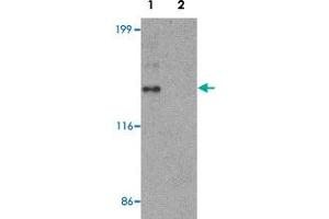 Western blot analysis of HeLa cell lysate with ZNF521 polyclonal antibody  at 1 ug/mL in (1) the absence and (2) the presence of blocking peptide.